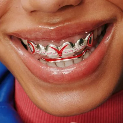 Loud Mouth LDN Launches Unique Grillz Inspired by Nissan's Automotive Design